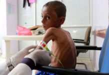 Μετά τον πόλεμο και την πείνα, χολέρα και κοροναϊός : Η χώρα που υποφέρει περισσότερο από όλες