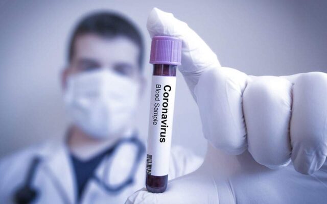coronavirus-teste-640x400