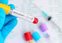 Γερμανία: 21.695 κρούσματα κορονοϊού και 379 θάνατοι το τελευταίο 24ωρο
