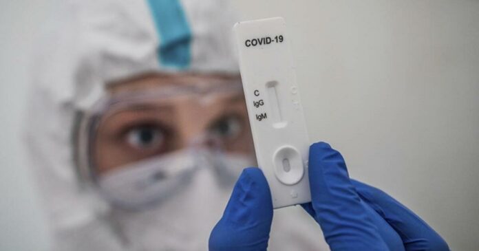 COVID TEST
