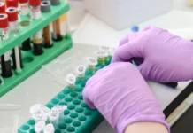 Δωρεάν διαγνωστικές εξετάσεις για βασικές ασθένειες ανακοίνωσε ο Μητσοτάκης στη ΔΕΘ